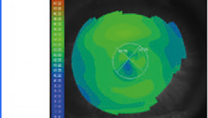 Axial Map OD