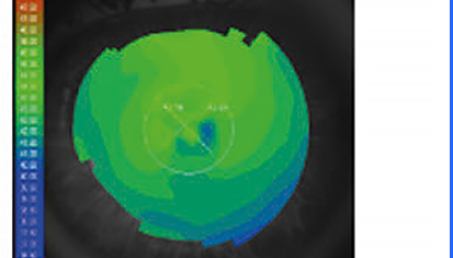 Axial Map OS