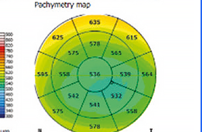 Pachymetry Map OS